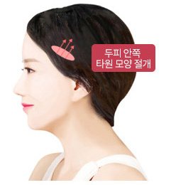 관자거상 두피 안쪽 타원 모양 절개 위치(모델 옆얼굴)